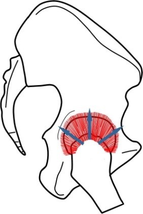 股関節屈曲位の図