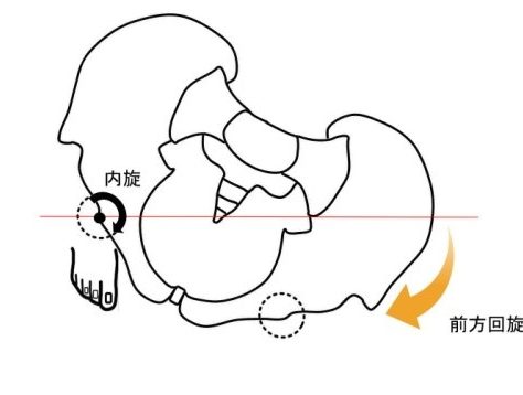 骨盤の前方回旋