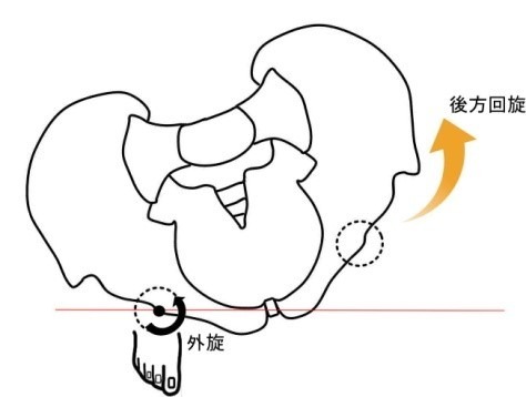 骨盤の後方回旋